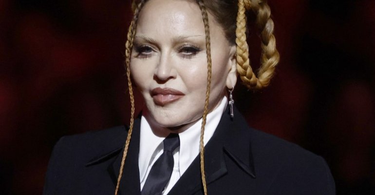 Madonna: Πλαστικός χειρούργος αποκαλύπτει όλα όσα έχει κάνει στο πρόσωπό της!